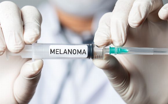New mRNA Vaccine Reduces Risk of Melanoma Recurrence by Over 40 Percent